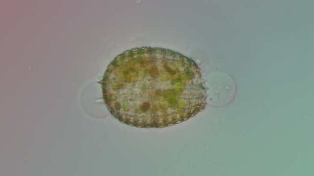 Microscopic Coleps ciliate at 50x under Nomarski DIC