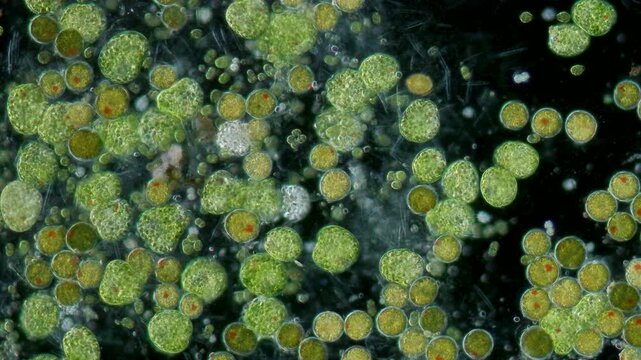 Euglena palmelloid stage at 10x under darkfield