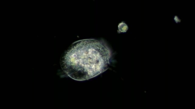 Euplotes ciliate at 20x under darkfield microscopy
