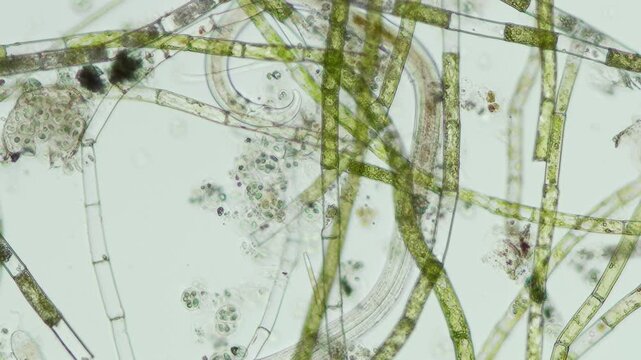 Microspora amoena at 10x under brightfield microscopy