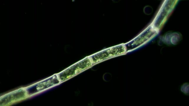 Microspora filament at 20x under darkfield microscopy