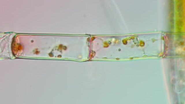 Microspora amoena at 50x under Nomarski DIC microscopy