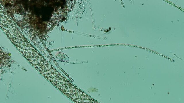 Peritrich Ciliate at 10x Under Nomarski DIC Microscopy