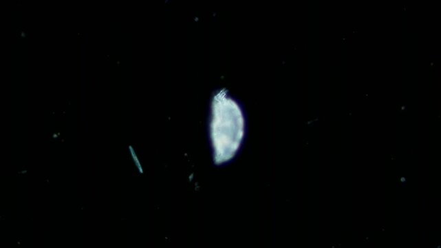 Unidentified rotifer at 10x under darkfield microscopy