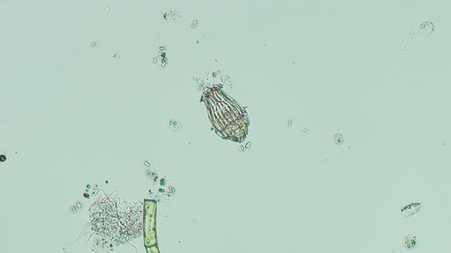 Unidentified rotifer at 20x under brightfield microscopy