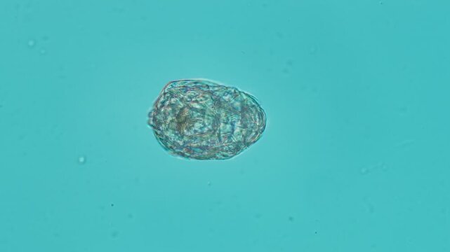 Unidentified rotifer at 20x under Nomarski DIC