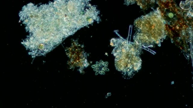 Synura colony at 10x under darkfield microscopy