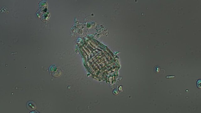 Rotifer close-up at 50x under Nomarski DIC microscopy