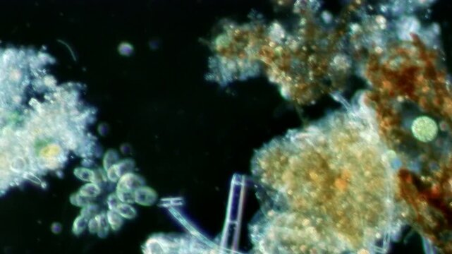 Synura golden algae at 20x under darkfield microscopy