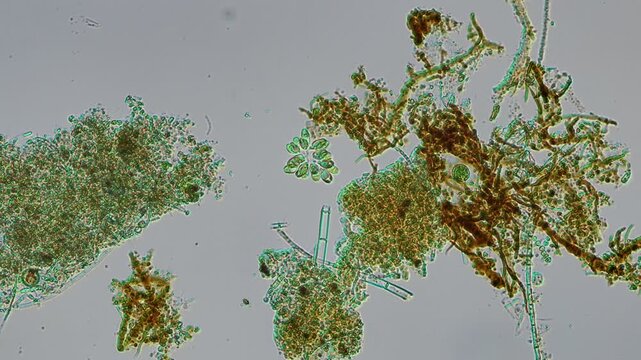 Synura colony at 10x under Nomarski DIC microscopy