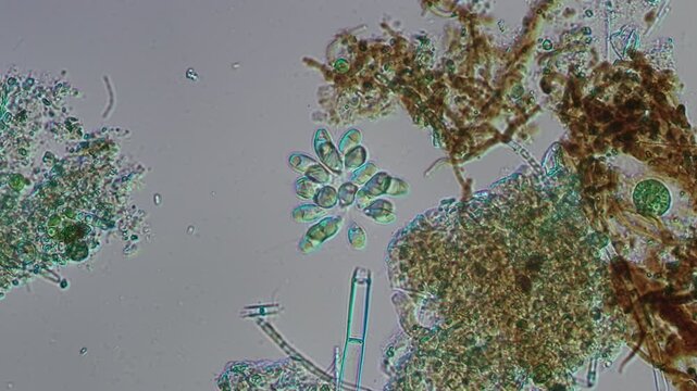 Synura colony at 20x under Nomarski DIC microscopy