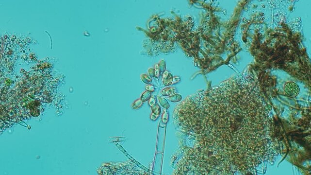 Synura colony close-up at 20x under Nomarski DIC