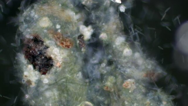 Tachysoma ciliate at 20x under darkfield microscopy