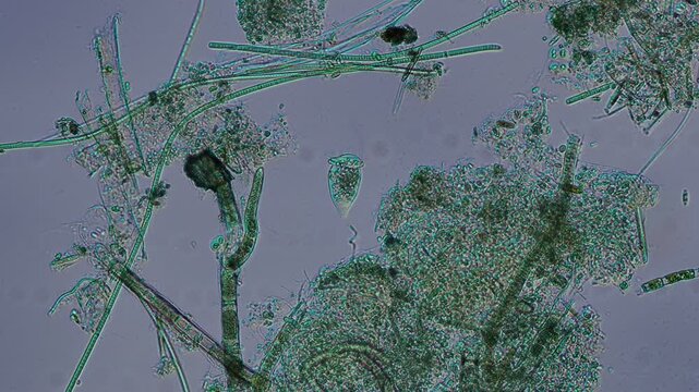Vorticella ciliate at 10x under Nomarski DIC microscopy