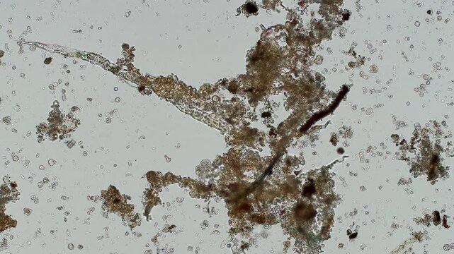 Unidentified ciliate at 10x under brightfield microscopy