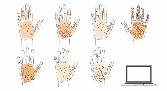 Line art vector illustration set of female palm shape types showing anatomical skeletal bone structures, hand creases, and palmistry lines; includes a laptop computer display icon.