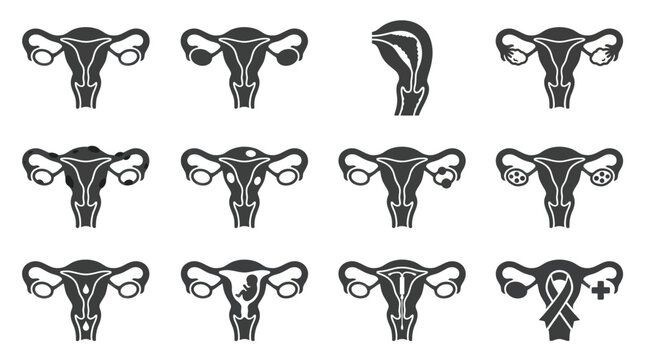 Uterus icons set featuring anatomy pregnancy and medical conditions