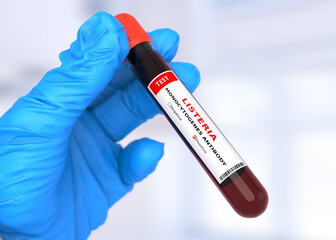 Fototapeta premium A doctor wearing a glove holds a blood test tube with a positive result for Listeria monocytogenes infection.