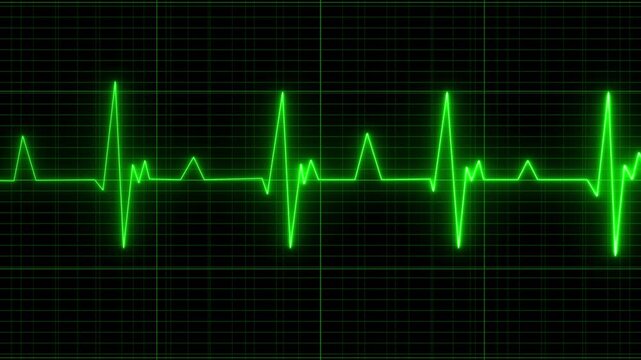  Glowing neon line heartbeat icon. Abstract neon heartbeat signal icon animation .  Sundar background. Green Green Color heartbeat signal animation , Heart bit  