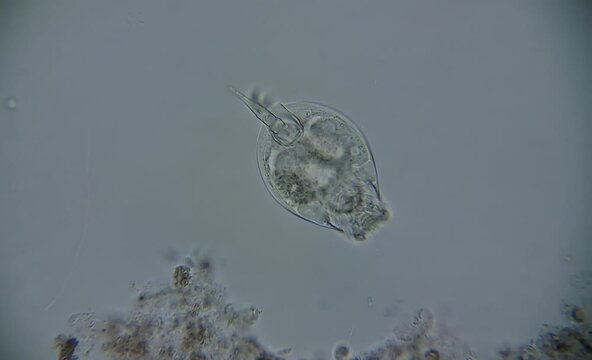 image of aquatic microorganisms under the microscope
