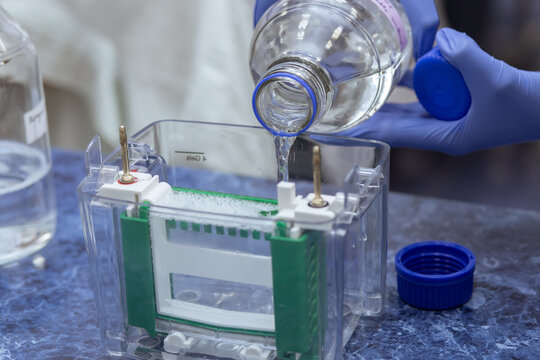 The gel electrophoresis chamber is filled with a buffer solution from a flask.