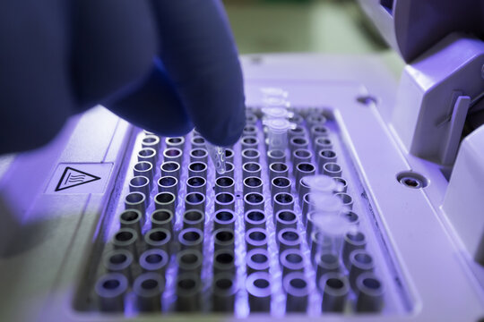 Conducting PCR studies to identify human genetic diseases.