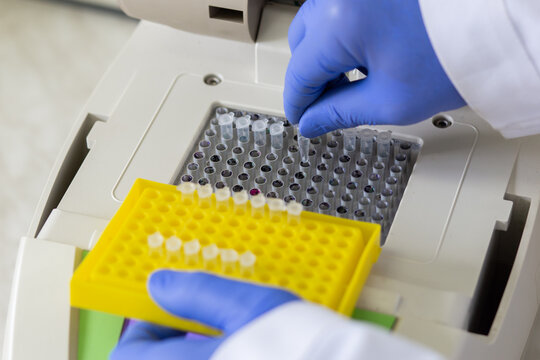 A scientist sets up small Eppendorf tubes with samples for detection on a detector. A DNA amplifier is loaded with samples in test tubes.