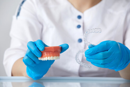 Orthodontist showing the system of aligners on artificial jaws