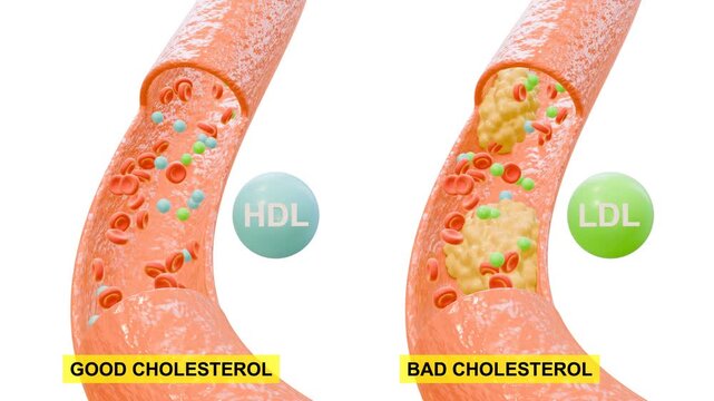 3D Animation of Good Cholestrol and Bad Cholesterol. Suitable for student learning and presentations.