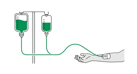 Obraz premium Medical Infusion Process With Liquids Flowing To A Patient's Hand In Simplistic Art