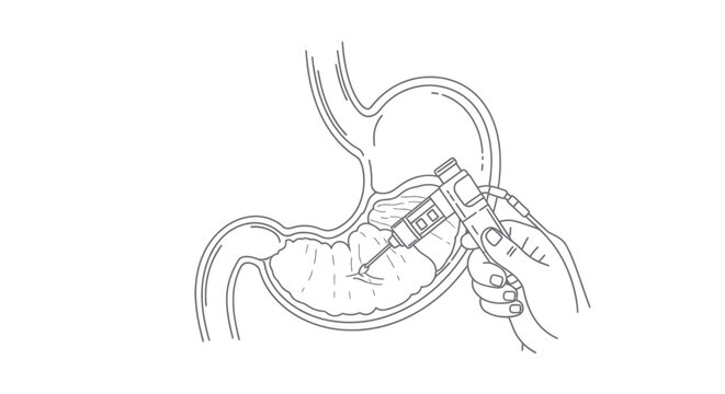 Endoscopy Procedure Medical Vector Illustration