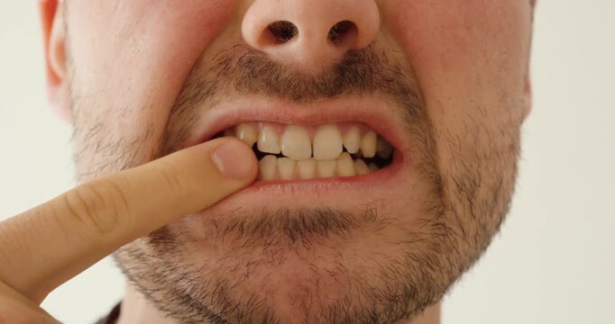 Close-up of a man pointing at stained or yellow teeth, highlighting dental discoloration and oral hygiene concerns.