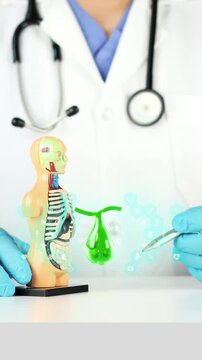 The doctor holds an anatomical model next to a 3D digital model of the gallbladder with gallstones. Digestive health, gastroenterology, gallstone prevention, cholelithiasis, and early diagnosis.
