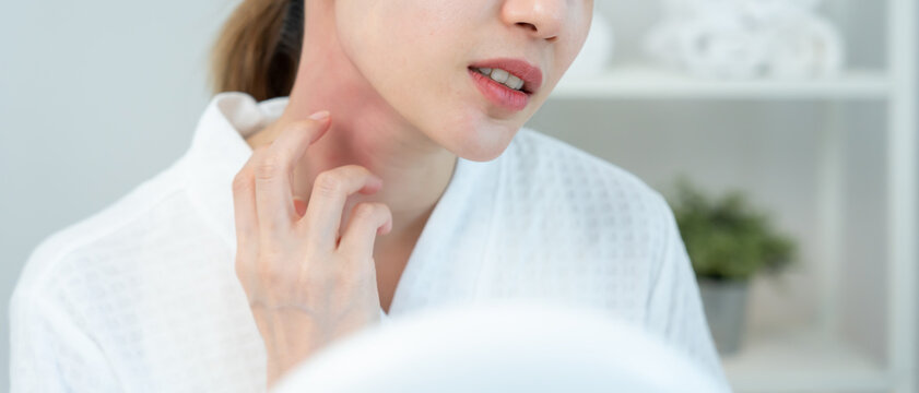 Skin and beauty problems Women have itchy skin and red rashes from cosmetic allergies, steroid allergies, sensitive skin, redness from sunlight, chemical allergies, rashes, insect bites.