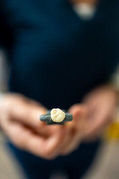 Dentist Holding Extracted Molar Tooth on Dental Instrument