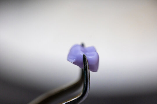 Purple Dental Crown Held on Surgical Instrument Tip