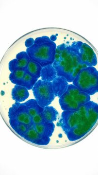 Microbiology research experiment with bacteria growth in petri dish agar culture, biotechnology laboratory study of microorganism proliferation and microscopic analysis of colorful bacterial colonies