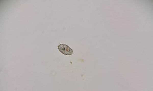 microorganisms in water, ciliated microorganism