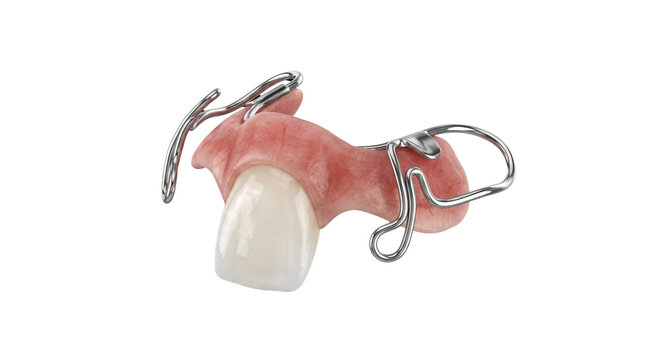 Dental orthodontic appliance laboratory setting medical equipment clinical environment close-up view oral health concept