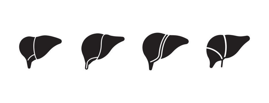 Liver anatomy illustrations showing different views of human liver organ with white lines indicating sections and lobes  medical diagrams for educational purposes