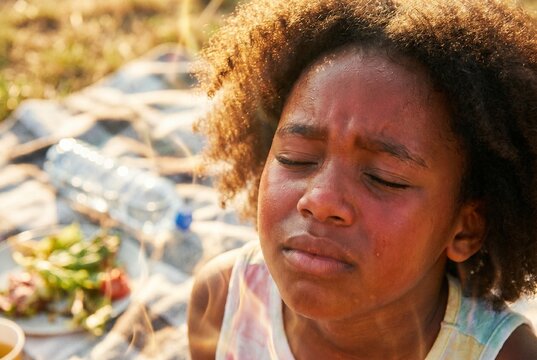 Close-up of a distressed African American girl suffering from heatstroke and extreme heat during a summer picnic. Sweating, red face, dehydration, and unprotected sun exposure without a hat