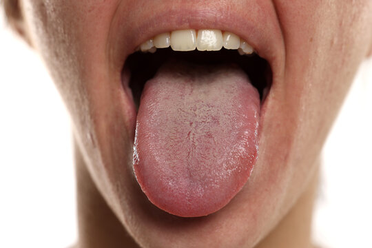 Extreme close up portrait of woman showing tongue with white coating and oral health problem on white background.