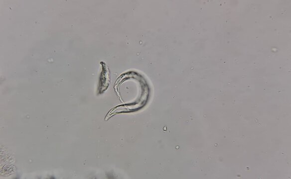 image of microorganisms under the microscope