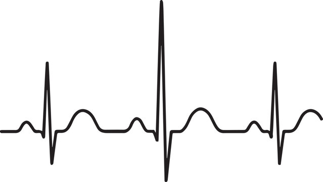 Electrocardiogram heartbeat rhythm pattern