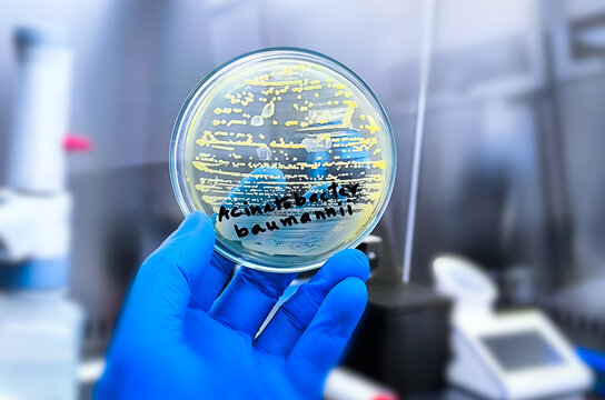 Microbiologist holding petri dish with bacterial collony of Acinetobacter Spp. Acinetobacter baumannii