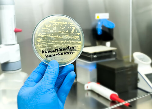 Microbiologist holding petri dish with bacterial collony of Acinetobacter Spp. Acinetobacter baumannii