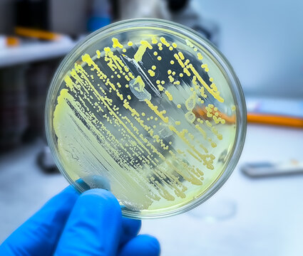 Microbiologist holding petri dish with bacterial collony of Acinetobacter Spp. Acinetobacter baumannii