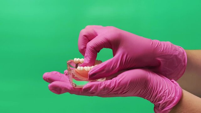 Dentist Placing Removable Implant-Supported Overdenture on Jaw Model