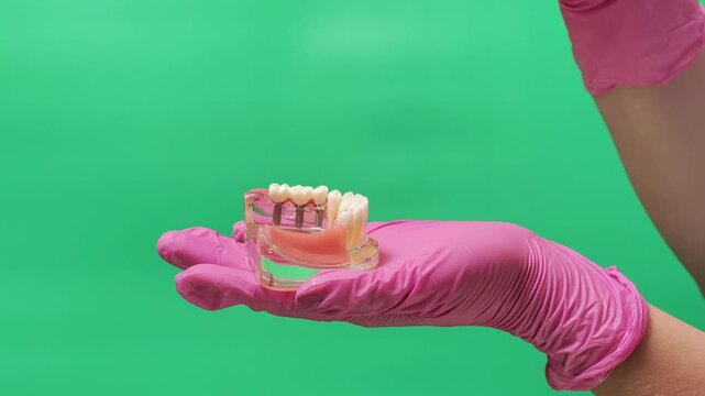 Dentist Removing Implant-Supported Bridge from Dental Jaw Model on Green Screen