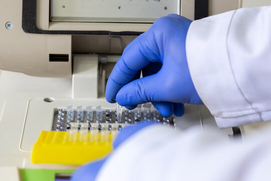 A research assistant places an Eppendorf tube with a sample into the PCR machine's wells.